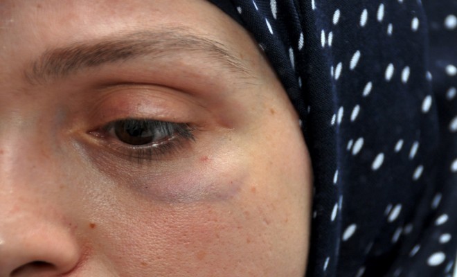 Almanyada 3 Türk Kadınına Saldırı